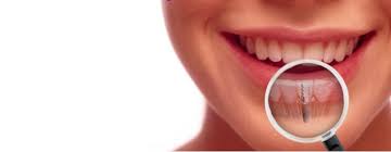 cost of tooth implant in bangalore, tooth implants in bangalore, dental implants in bangalore, dental implants cost bangalore, dental implants cost in bangalore,cost of  dental implants in bangalore