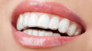 BEST INVISIBLE RETAINERS, BEST INVISIBLE ALIGNERS FOR TEETH, BEST INVISIBLE ALIGNERS, INVISIBLE ALIGNERS NEAR ME, BEST INVISIBLE TEETH ALIGNERS,
