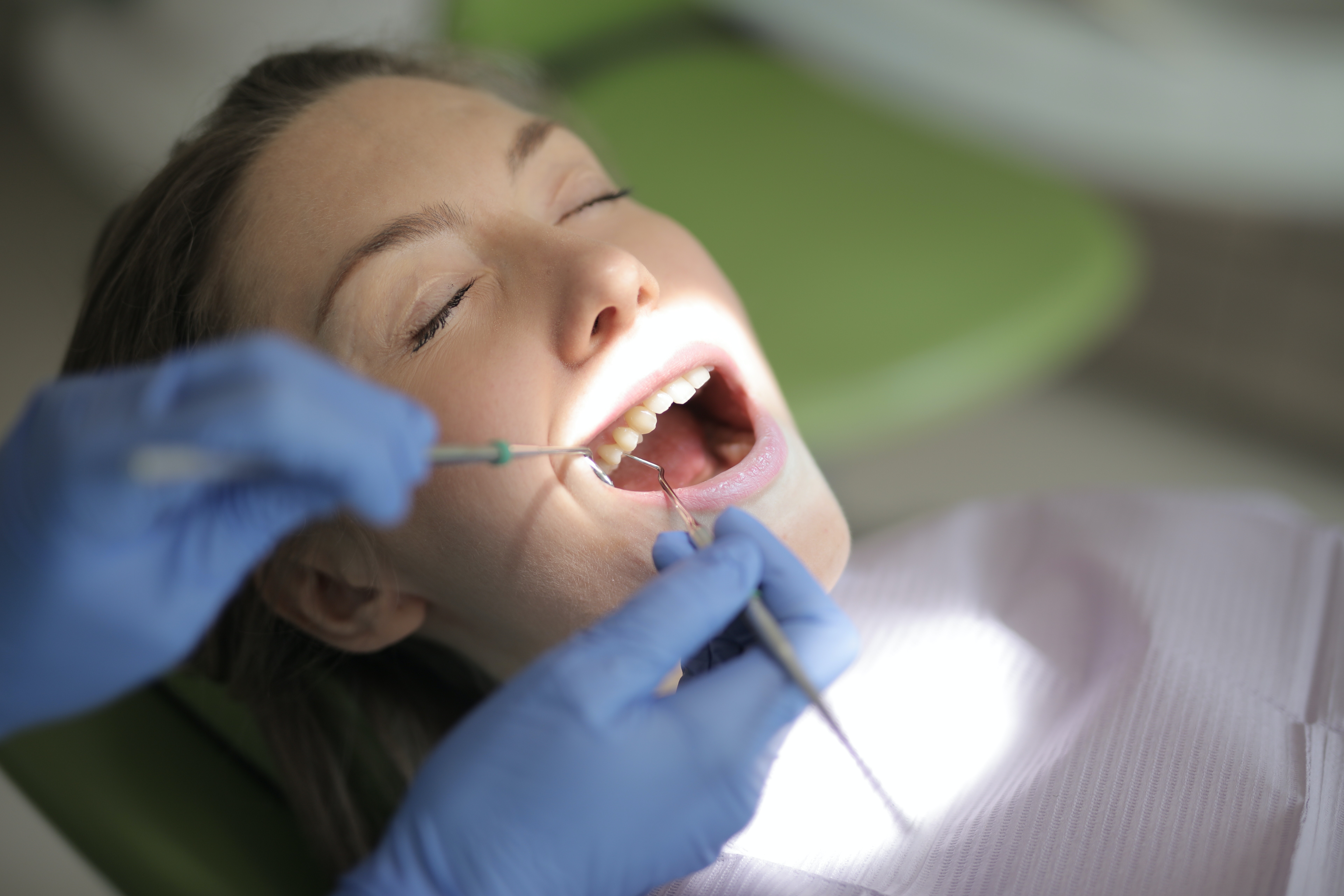 single sitting root canal treatment cost in bangalore, Root canal treatment, SINGLE SITTING ROOT CANAL TREATMENT COST, RCT TREATMENT COST IN Bangalore, RCT CHARGES, RCT COST, RCT PRICE IN BANGALORE.