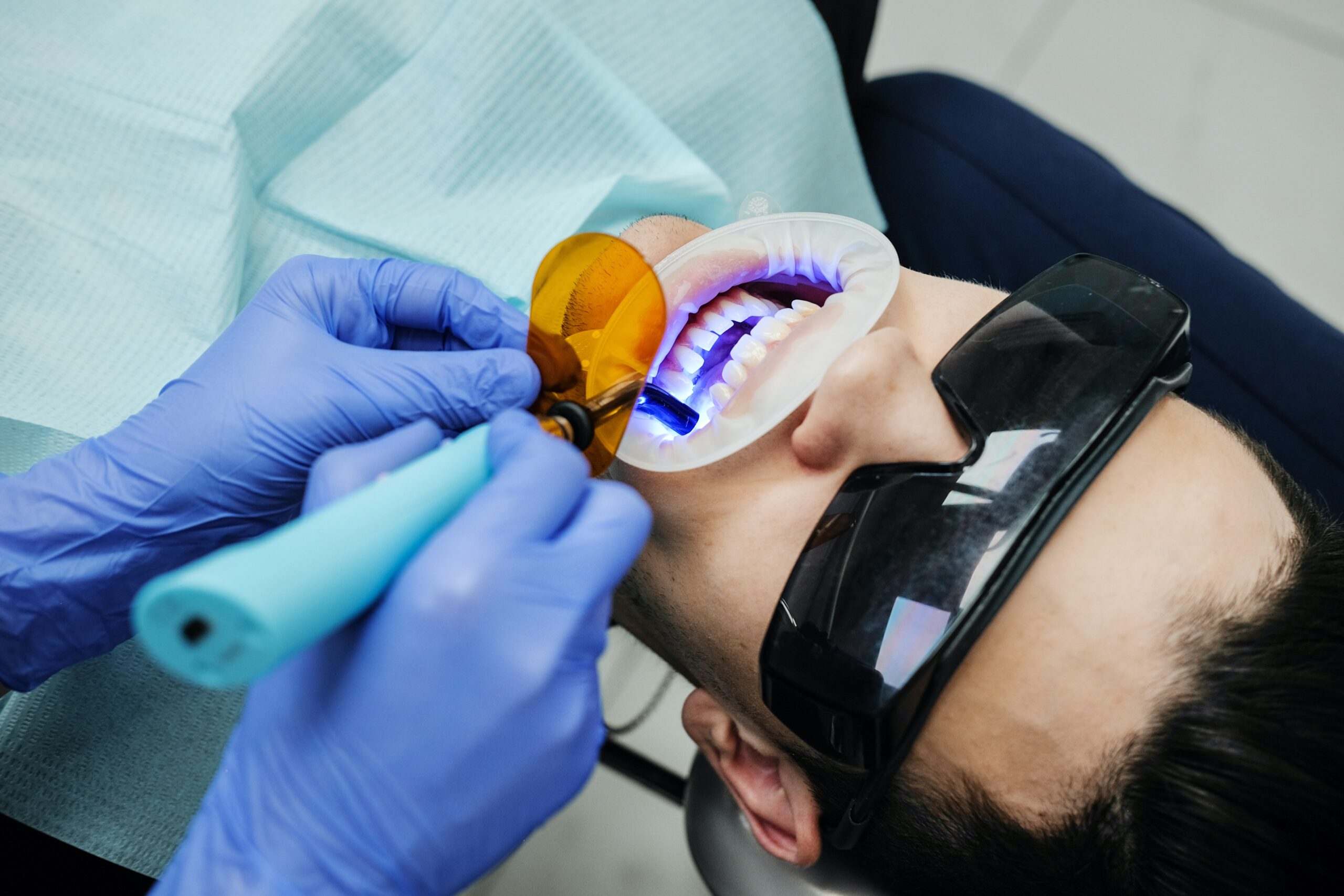 TEETH CLEANING AND WHITENING COST | TEETH CLEANING DENTAL CLINIC INDIRANAGAR | TEETH CLEANING CHARGES IN BANGALORE | TEETH CLEANING BANGALORE | ULTRASONIC TEETH CLEANING COST