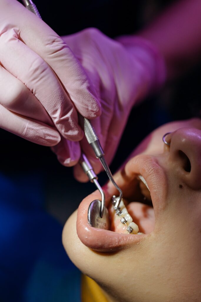 Laser implant, laser dental implants cost, laser treatment for dental implants, implant and laser dental centre, laser dental implants