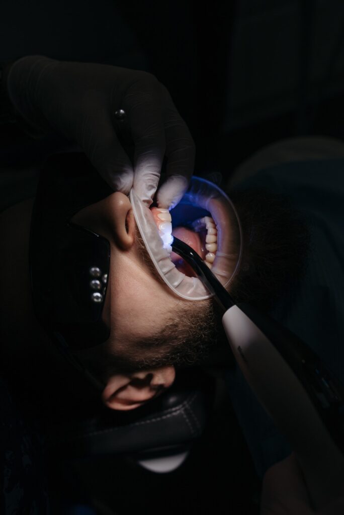 Laser teeth, laser bleaching teeth, laser teeth whitening price, laser teeth whitening results, teeth laser whitening near me